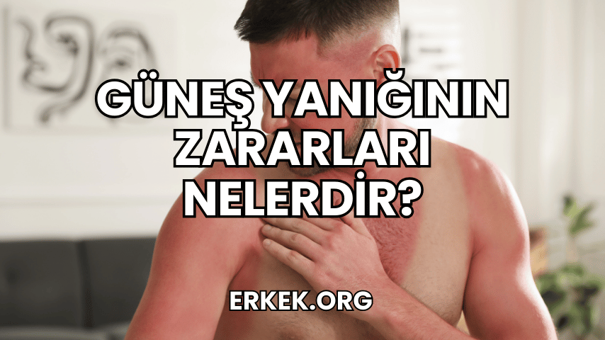 Güneş Yanığının Zararları Nelerdir?
