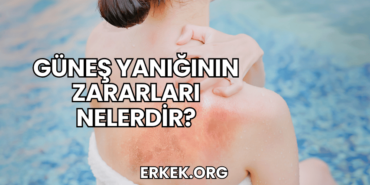Güneş Yanığının Zararları Nelerdir?