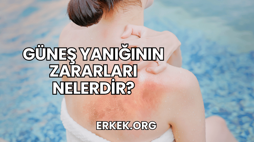 Güneş Yanığının Zararları Nelerdir?