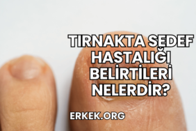Tırnakta Sedef Hastalığı Belirtileri Nelerdir?