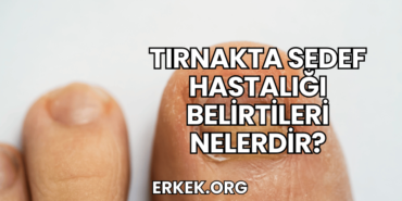 Tırnakta Sedef Hastalığı Belirtileri Nelerdir?